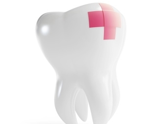 tooth restoration grants pass, restore teeth grants pass, cracked tooth dentest grants pass, teeth whitening grants pass