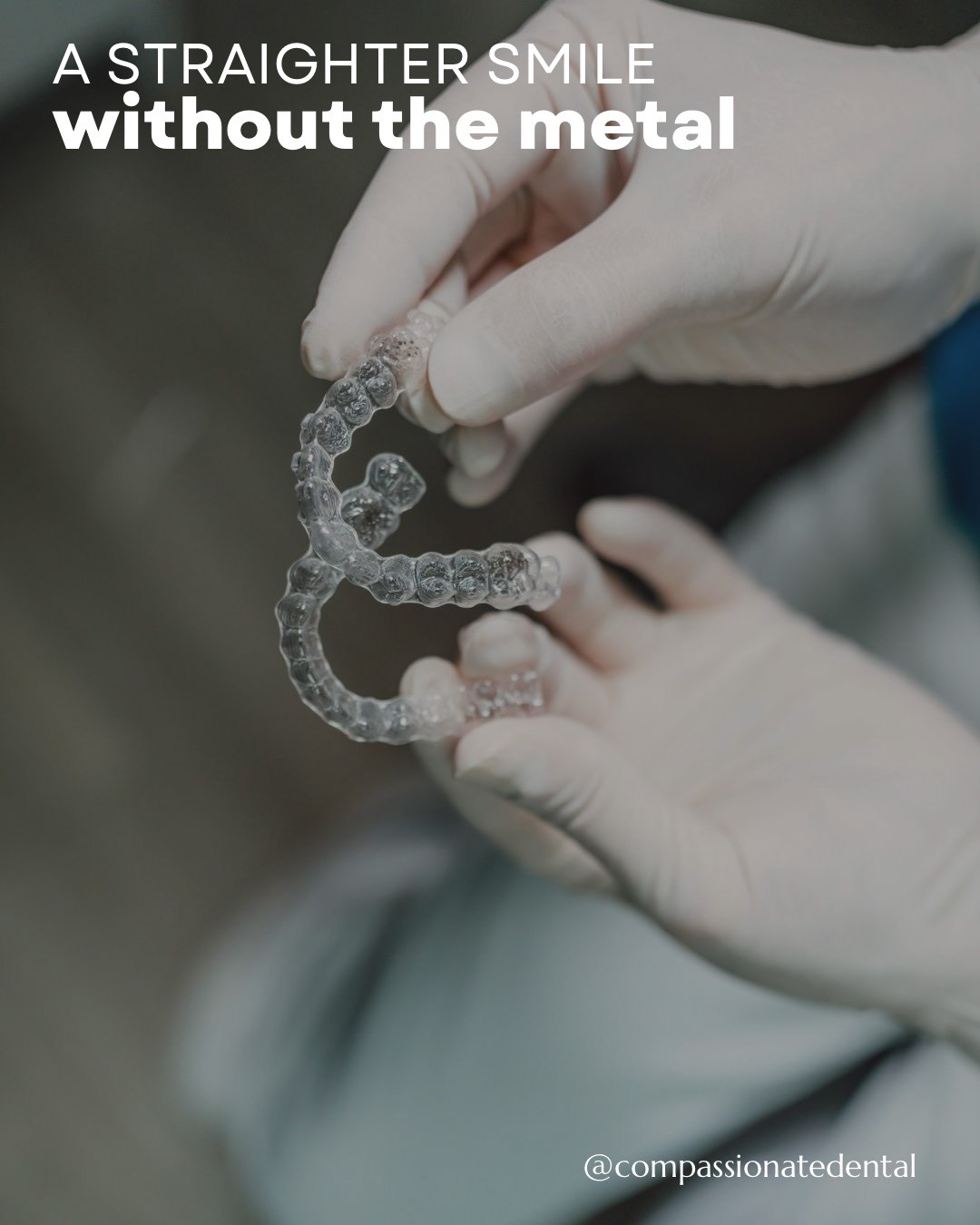 Invisalign: A Straighter Smile without the metal